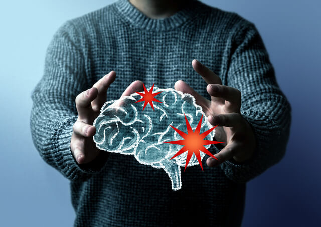 高次脳機能障害とは