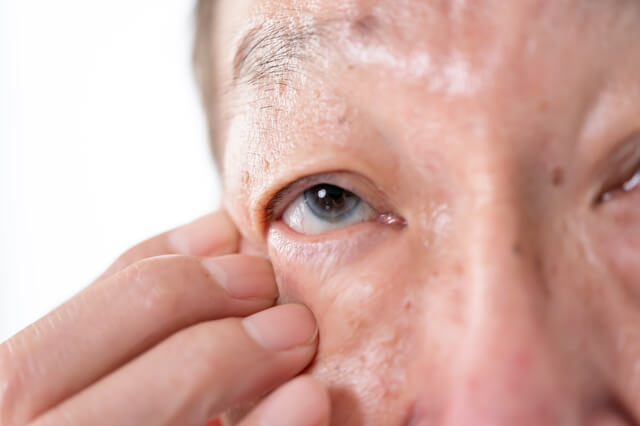 目に以上を感じる男性